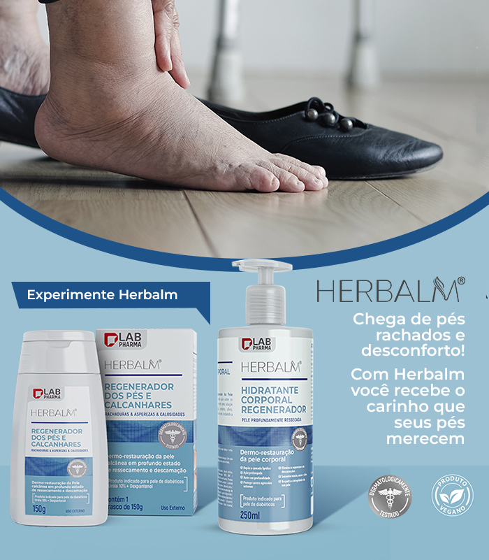 HERBALM